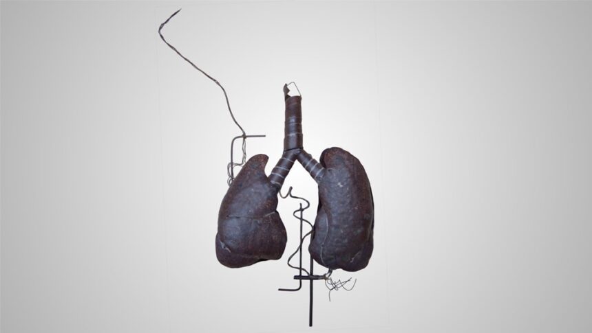 Exposição: ‘Dyspnoe/Dispneia’, da artista Janna Leonards